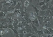 Stem cells